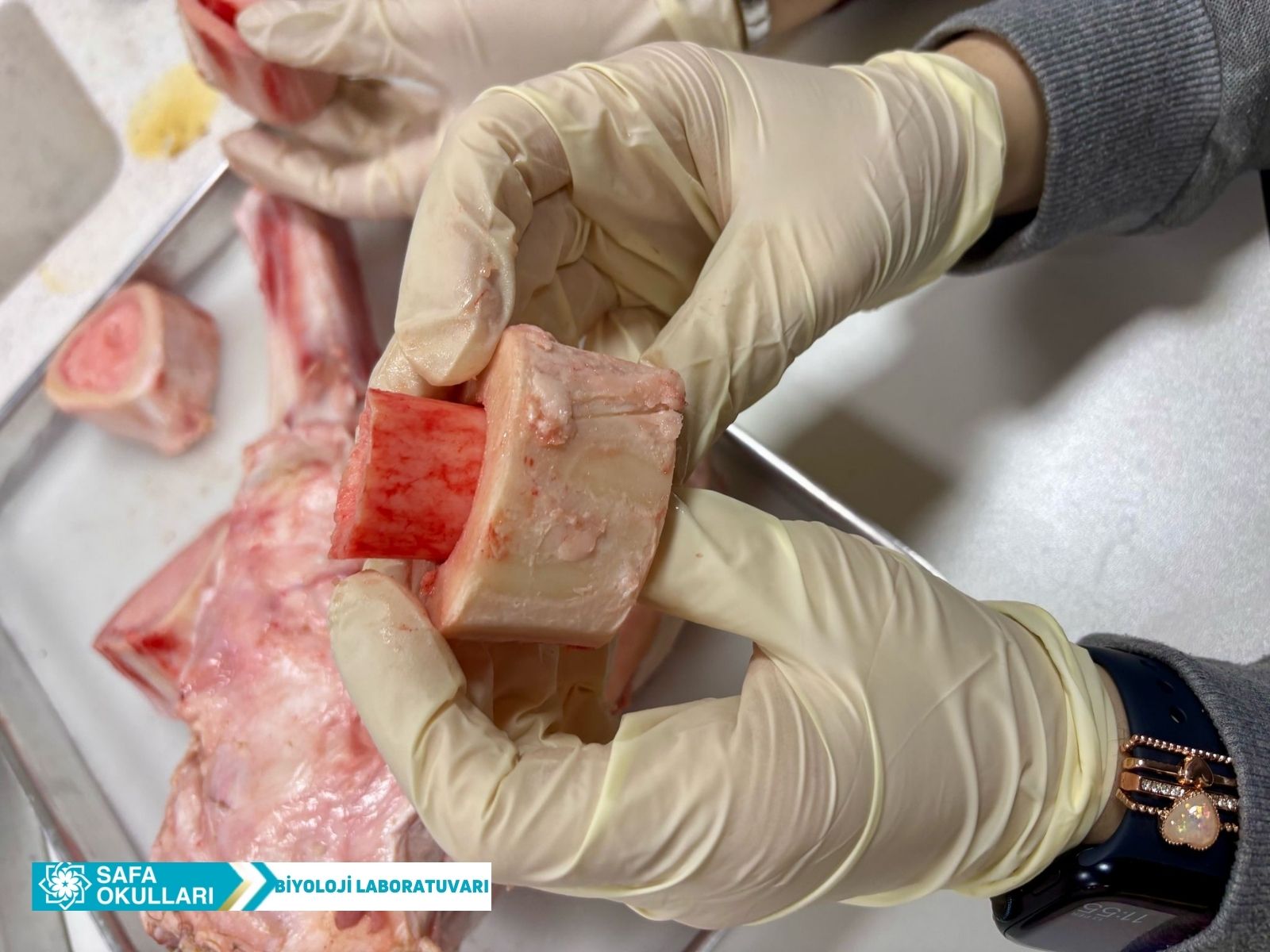 DESTEK VE HAREKET SİSTEMİ